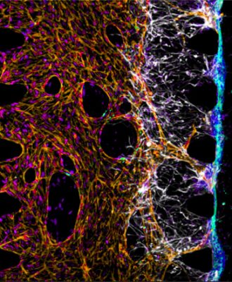 Blood-brain-barrier-media