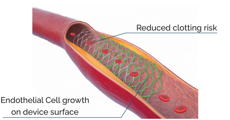 Camouflage Endothelialization Image (from brochure)