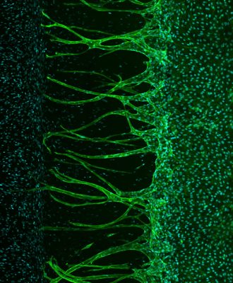 Vascular-Biology-angiogenesis